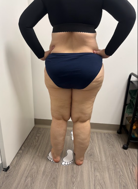 After Commencing Treatment