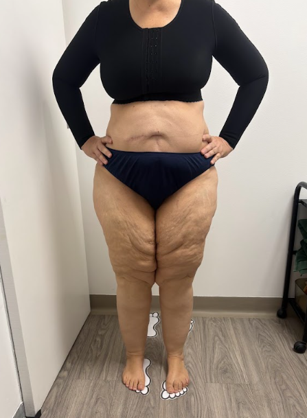 After Commencing Treatment