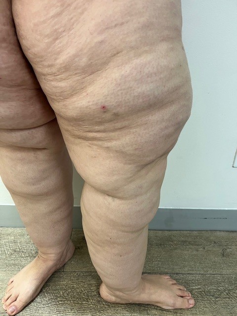 Before Starting Treatment