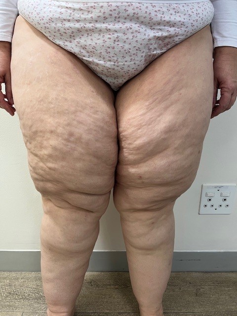 Before Starting Treatment